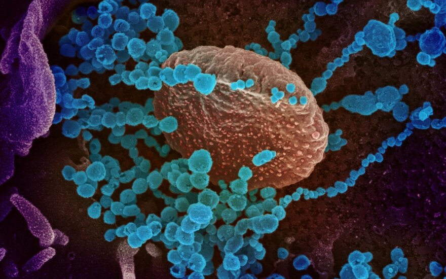 Kaip atrodo naujasis koronavirusas per mikroskopą