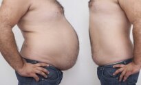 Įveikti svorio metimo kliūtis 5 būdai, kaip numesti kūno riebalus