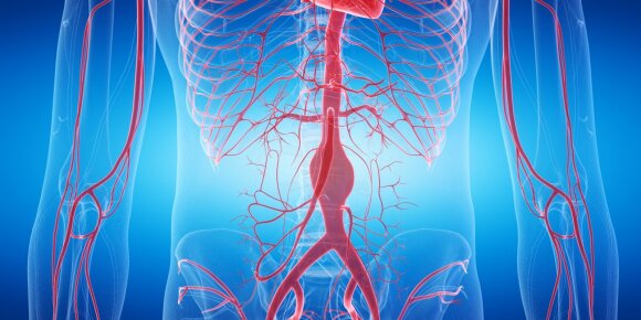 Aortic aneurysm