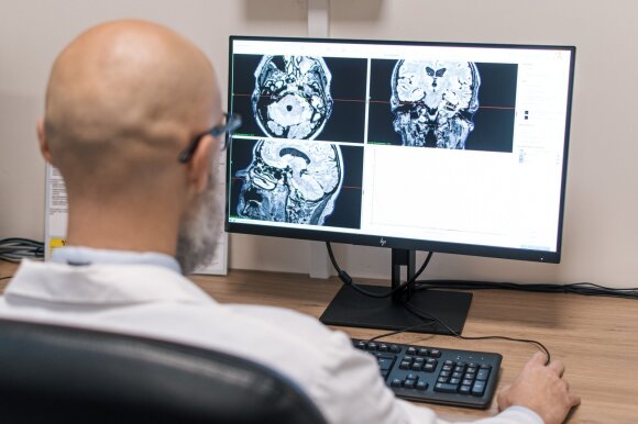 The doctor looks at X-rays of the brain.