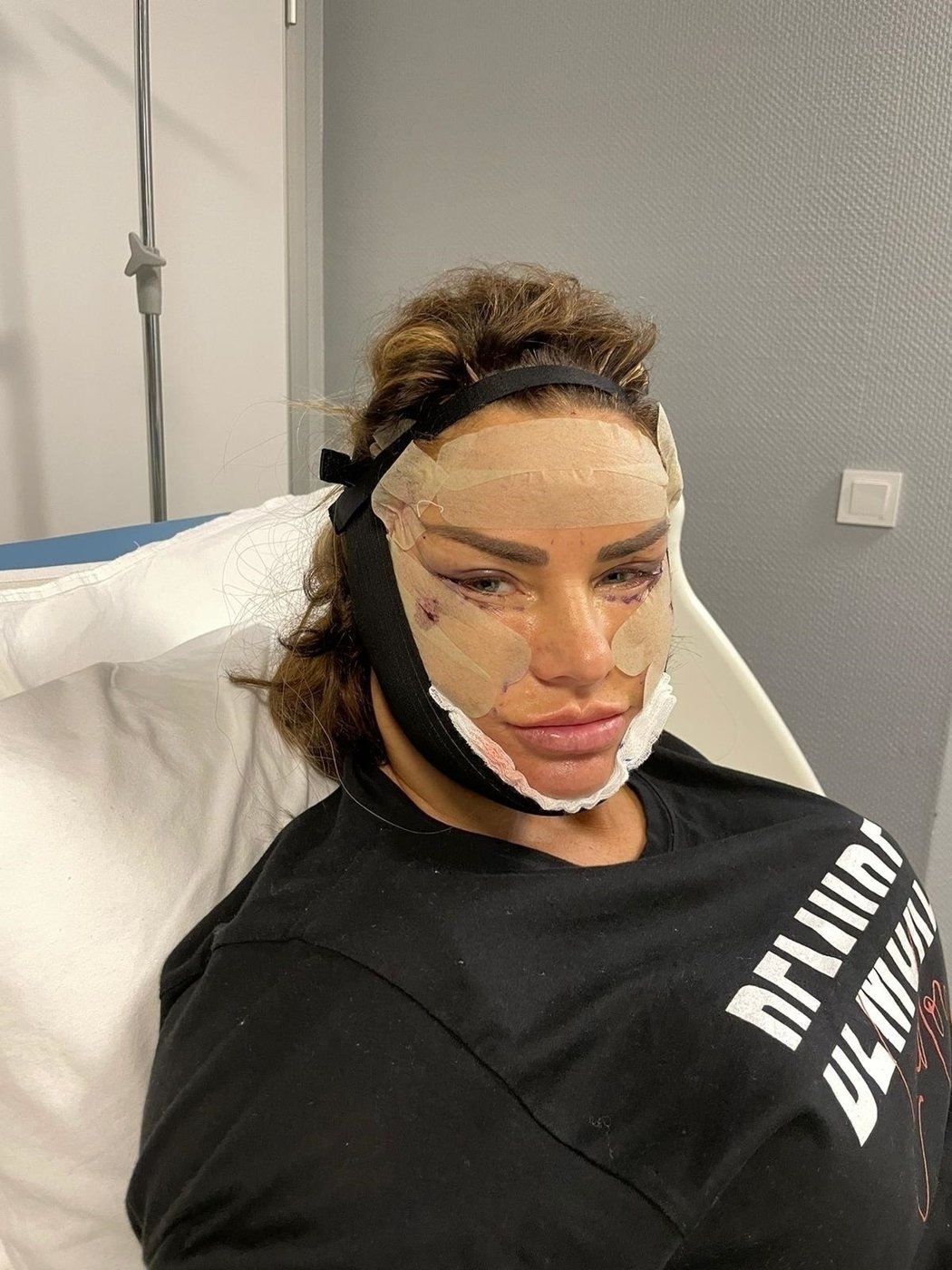 Priestaringai Vertinama Katie Price Ryzosi Dar 5 Plastinėms Operacijoms Paviesinti Vaizdai Kelia Klausima Ar Tai Tikrai Ji Delfi Veidai