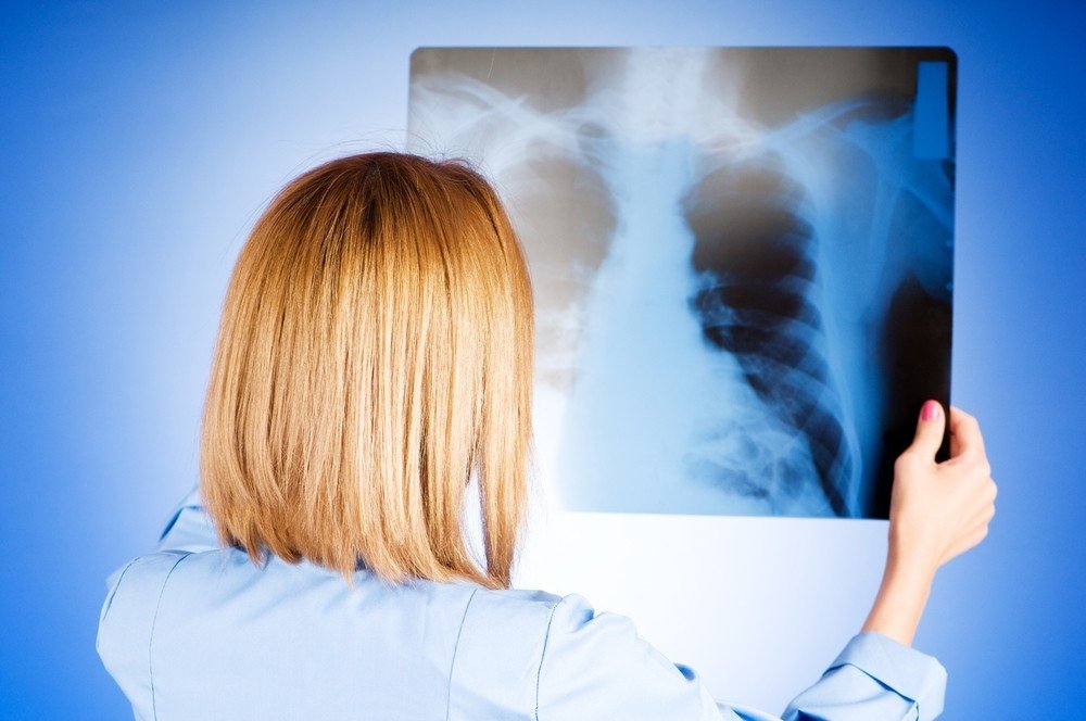 plaučių rentgeno nuotrauka esant hipertenzijai)