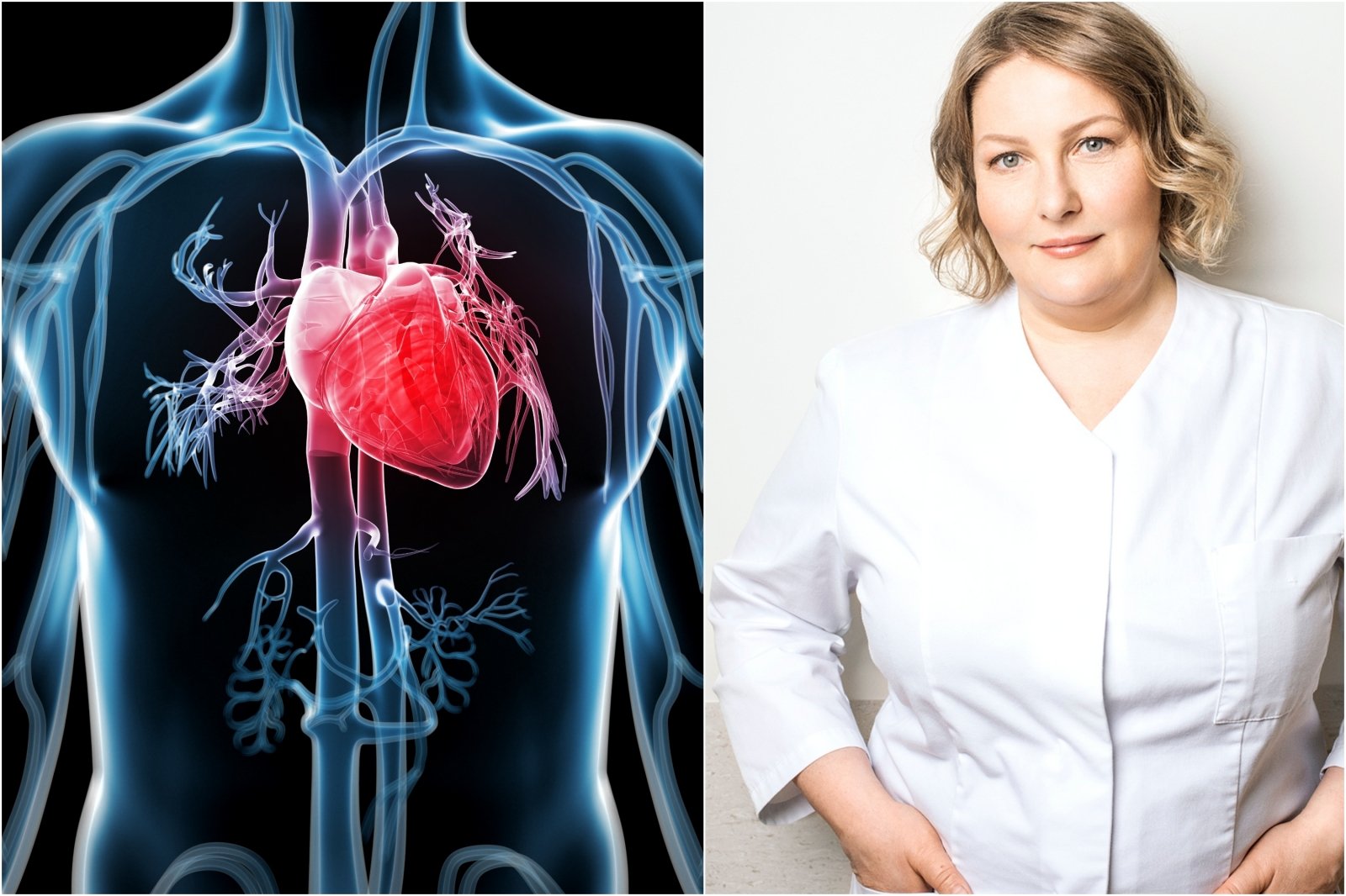 moterų sveikata širdies liga