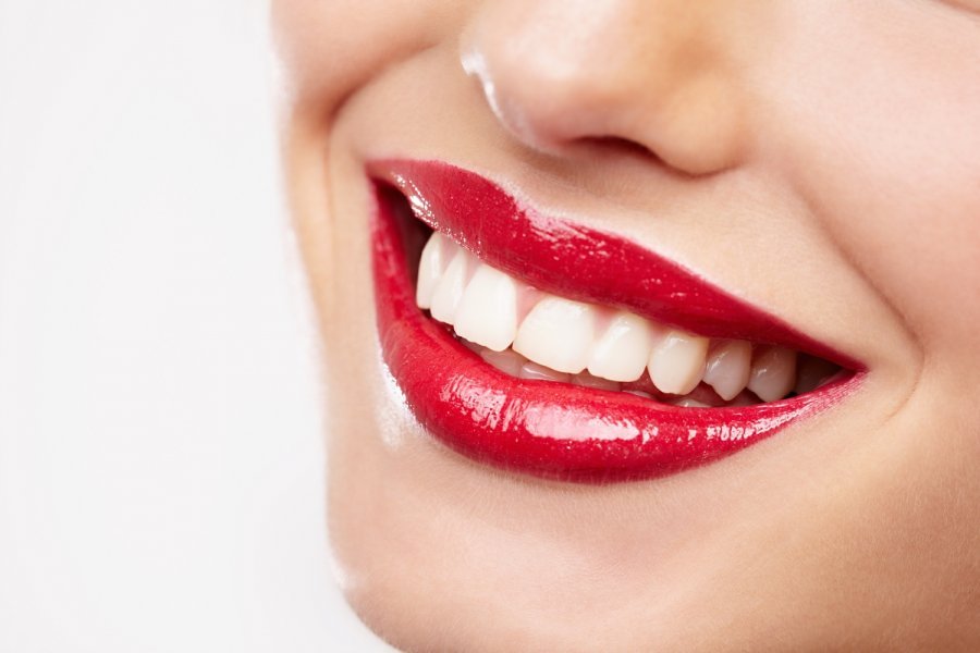 4 способа натурального отбеливания зубов - RU.DELFI